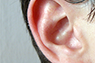 Hearing Impairment