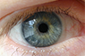 Visual Impairment